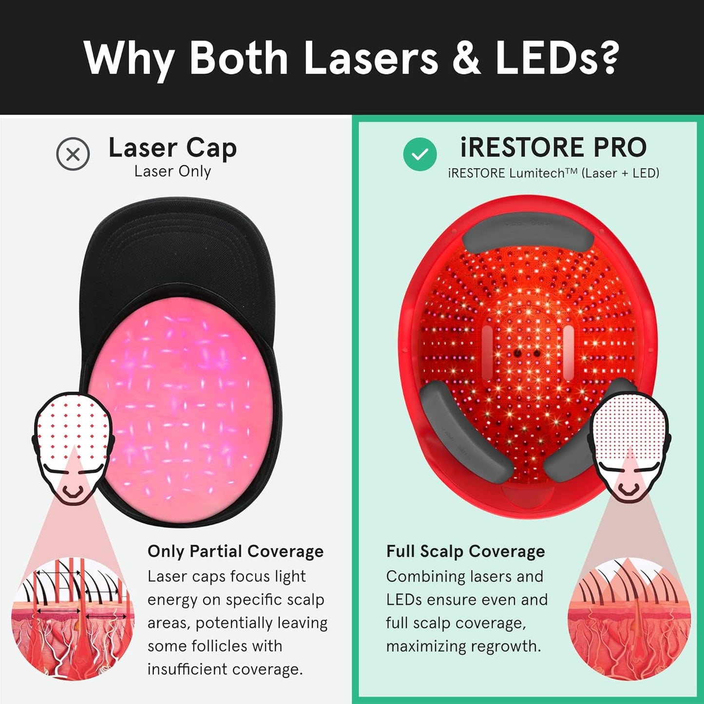 Professional Laser Red Light Therapy for Hair Growth System - FDA Cleared Hair Loss, Hair Thinning & Alopecia Treatment for Men & Women - Laser Cap for Hair Regrowth - 282 Lasers & Leds