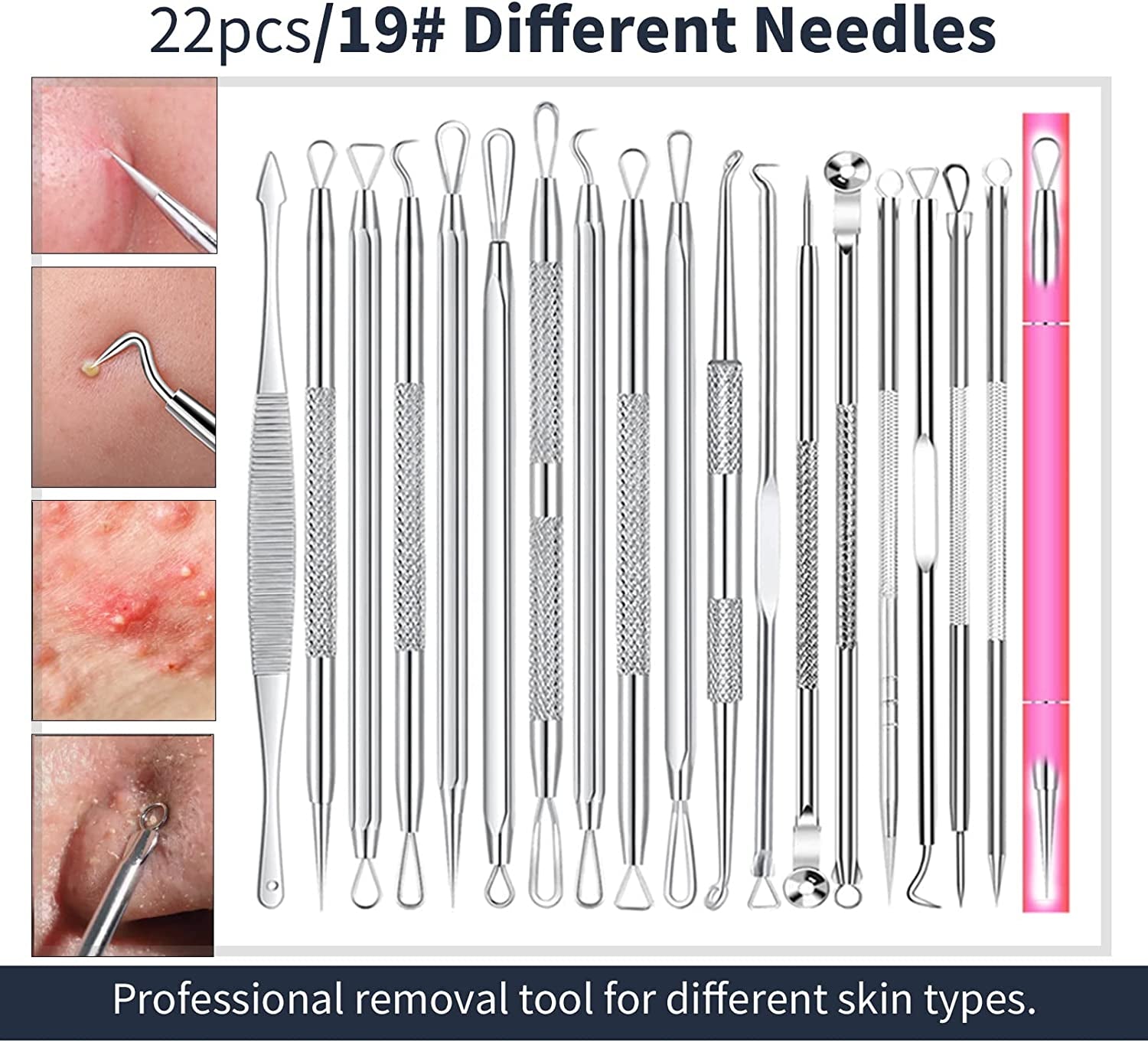 2024 Professional Pimple Popper Tool Kit - 22 PCS Blackhead Remover Tools for Acne and Zit Popping Comedone Extractor with Magnifying Glass and Alcohol Pad