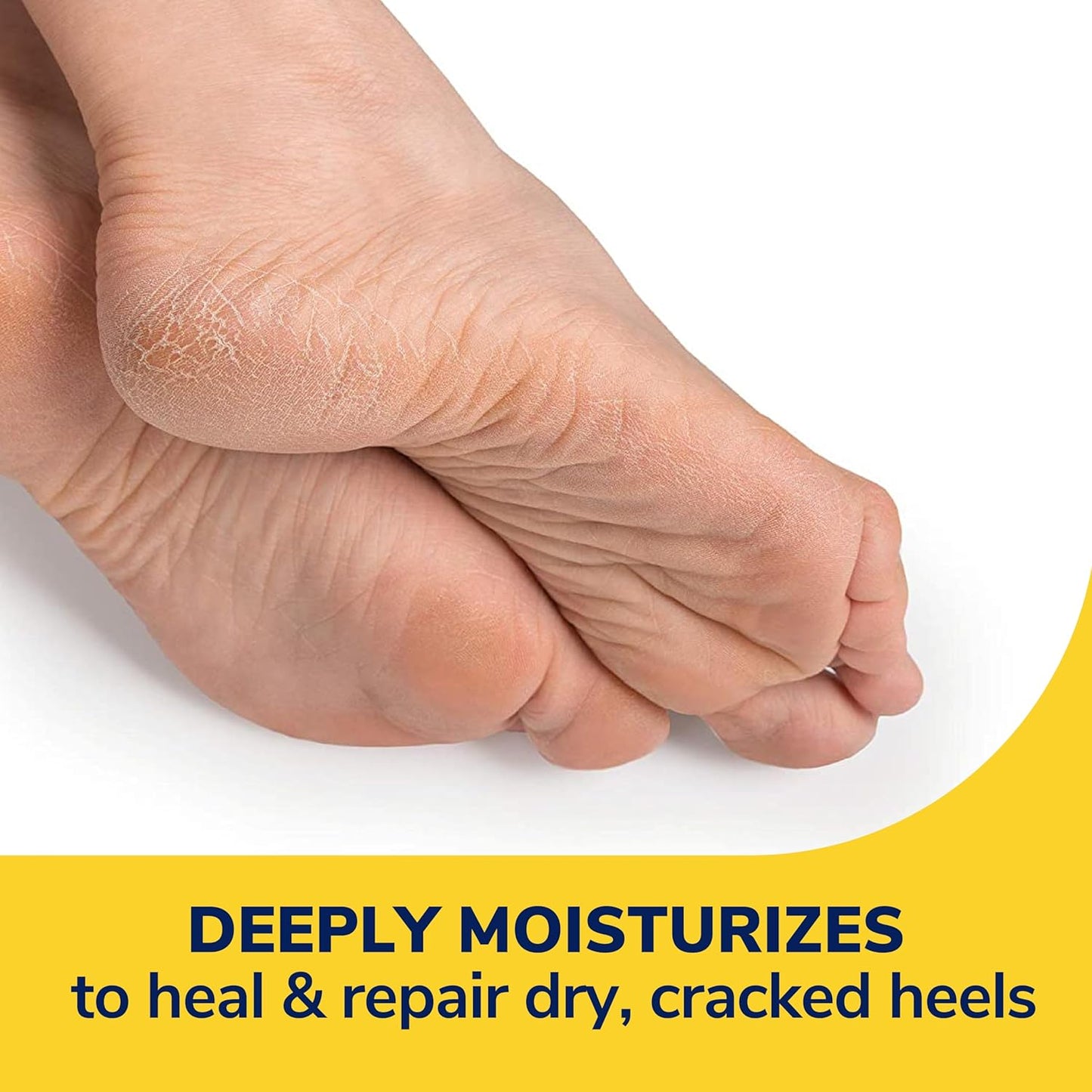 Severe Cracked Heel Repair Restoring Balm 2.5Oz, with 25% Urea for Dry, Cracked Feet, Heals and Moisturizes for Healthy Feet