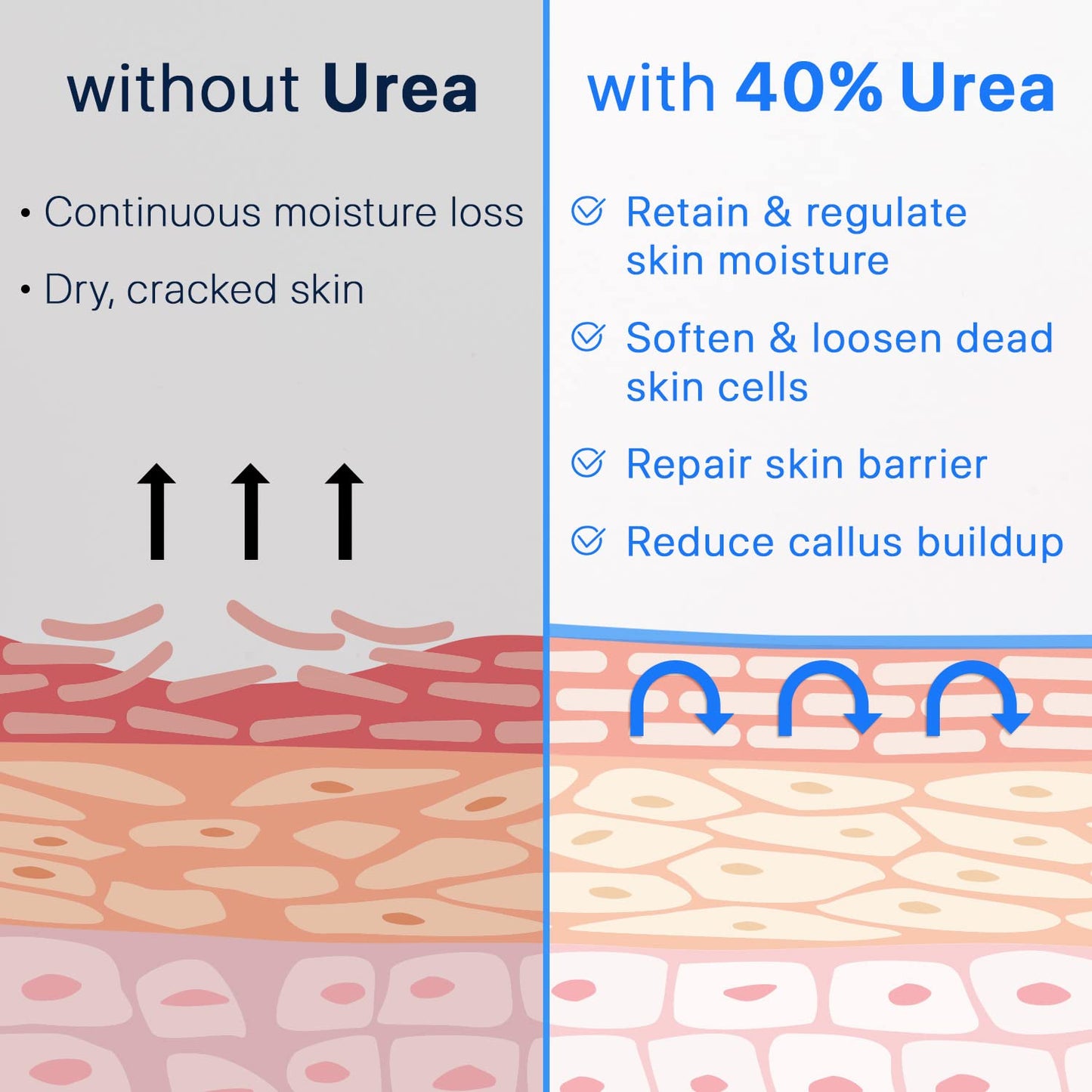 Urea Cream 40% plus Salicylic Acid 2%, Foot Cream for Dry Cracked Heels Feet Knees Elbows Hands, Foot Dead Skin Cuticle Callus Remover Toenail Softener, Keratolytic Skin Barrier Repair