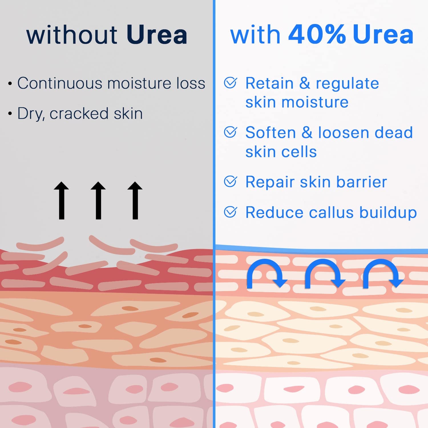 Urea Cream 40% plus Salicylic Acid 2%, Foot Cream for Dry Cracked Heels Feet Knees Elbows Hands, Foot Dead Skin Cuticle Callus Remover Toenail Softener, Keratolytic Skin Barrier Repair