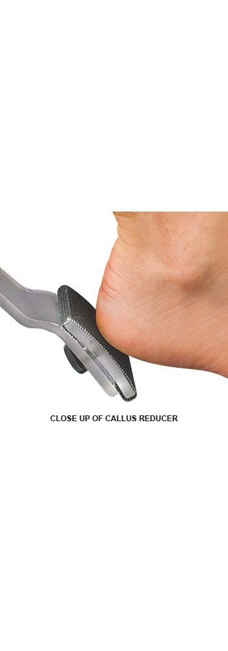 Callus Reducer