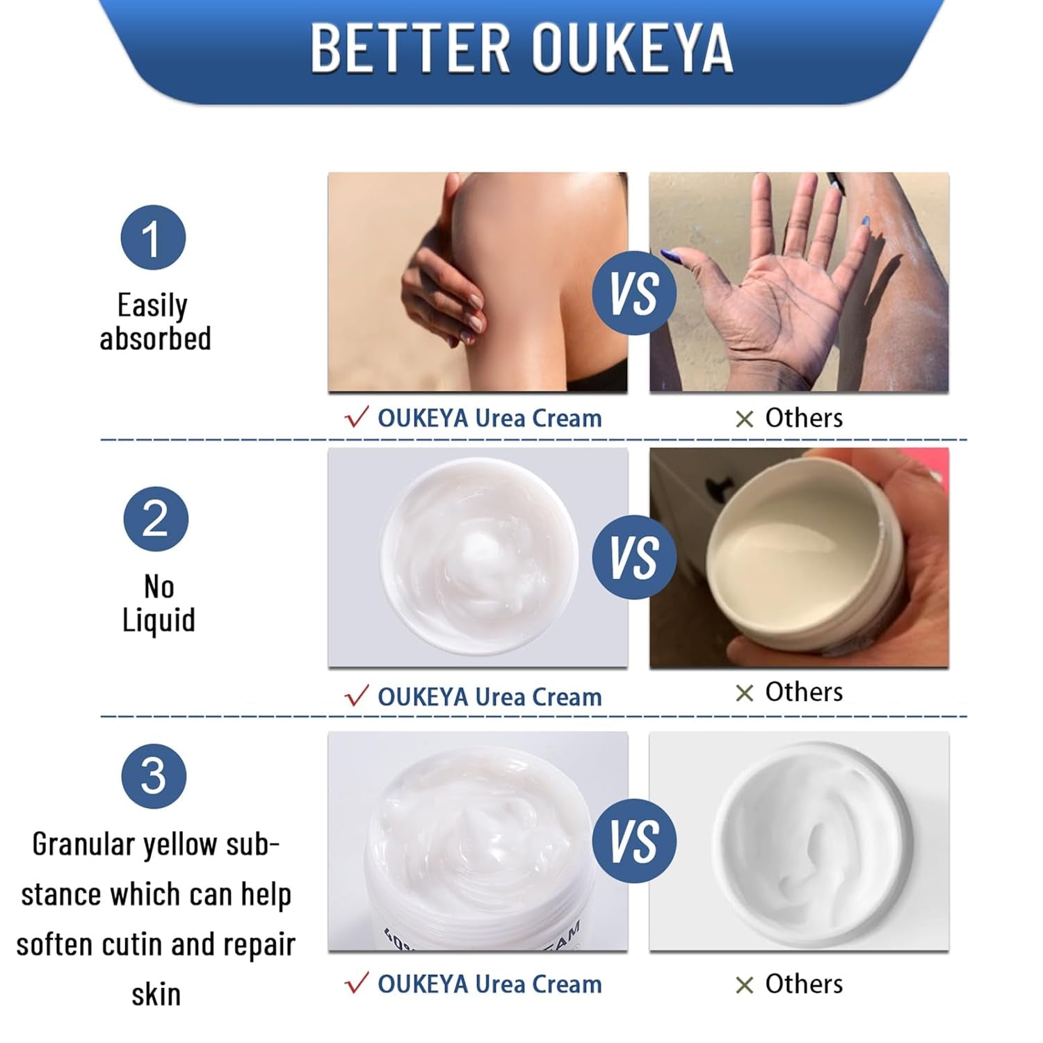 Urea Cream 40 Percent, Urea Foot & Hand Cream for Dry Cracked, 40 per Urea Lotion for Feet Maximum Strength