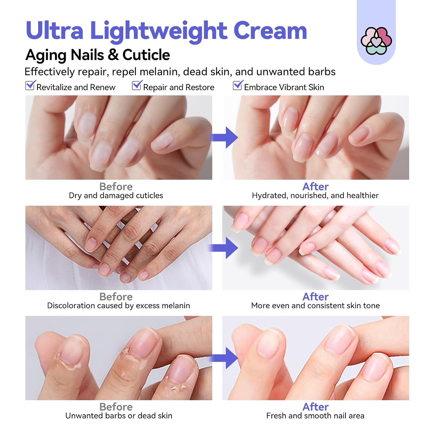 2024 Ultra-Repairing Cuticle Cream: 20Ml Organic Black Castor Oil Vitamin E Cuticle Softener for Deep Hydration Nail Care Aging Damaged Dry Cuticles Repair Nail Strengthener Home