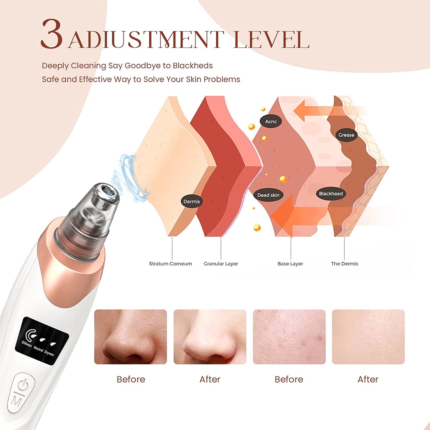 2024 Blackhead Remover Pore Vacuum,Facial Pore Cleaner-5 Suction Power,5 Probes,Usb Rechargeable Blackhead Vacuum Kit Electric Acne Extractor Tool for Adult (White)